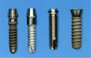 Foto: Different types of screw implants
